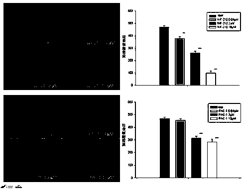 Application of oxadiazole piperazine compounds in preparing anti-angiogenesis drug