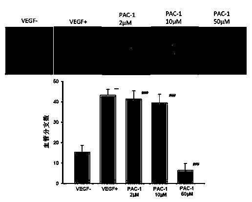 Application of oxadiazole piperazine compounds in preparing anti-angiogenesis drug