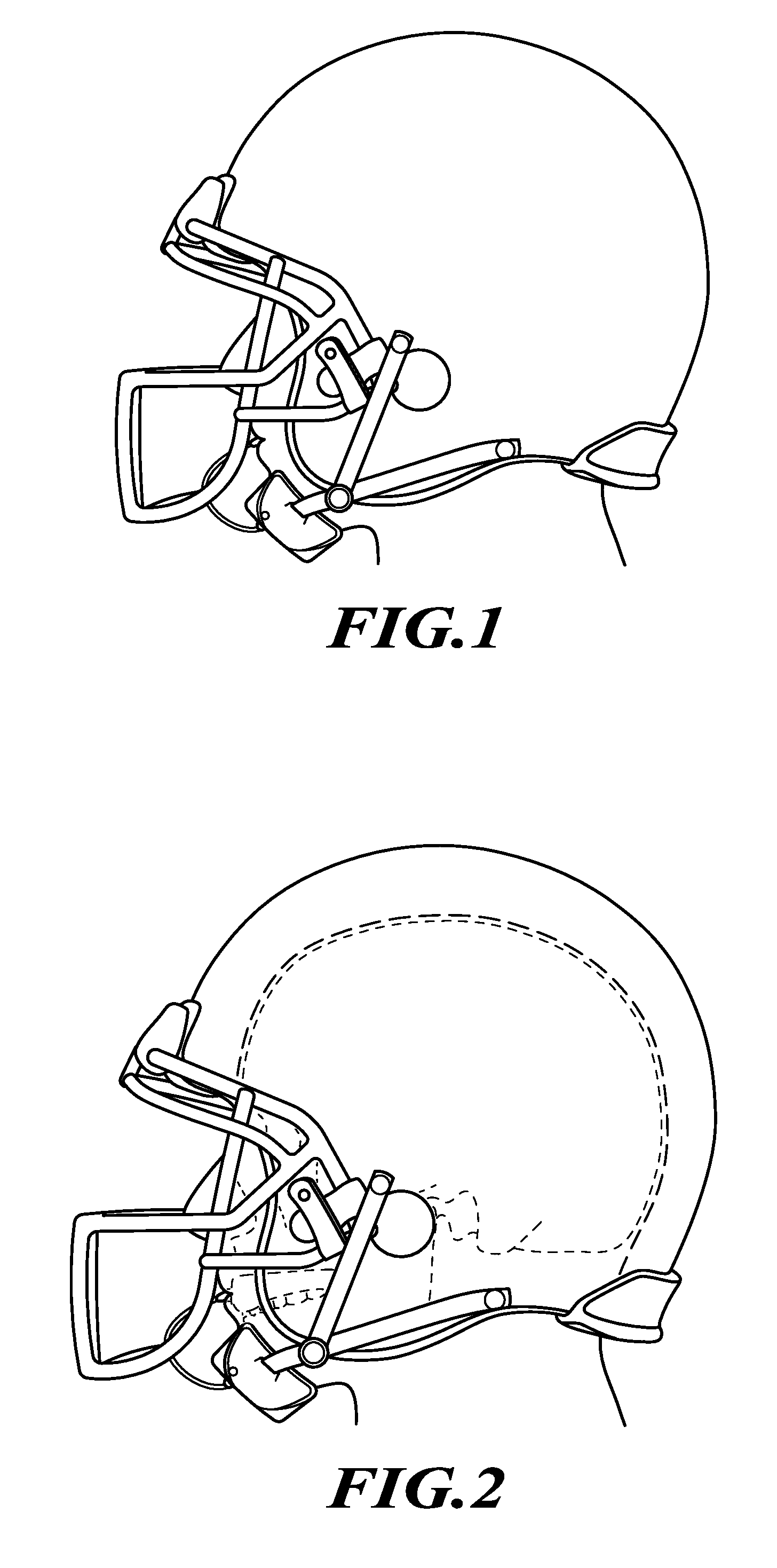 Mouth guard with sensor