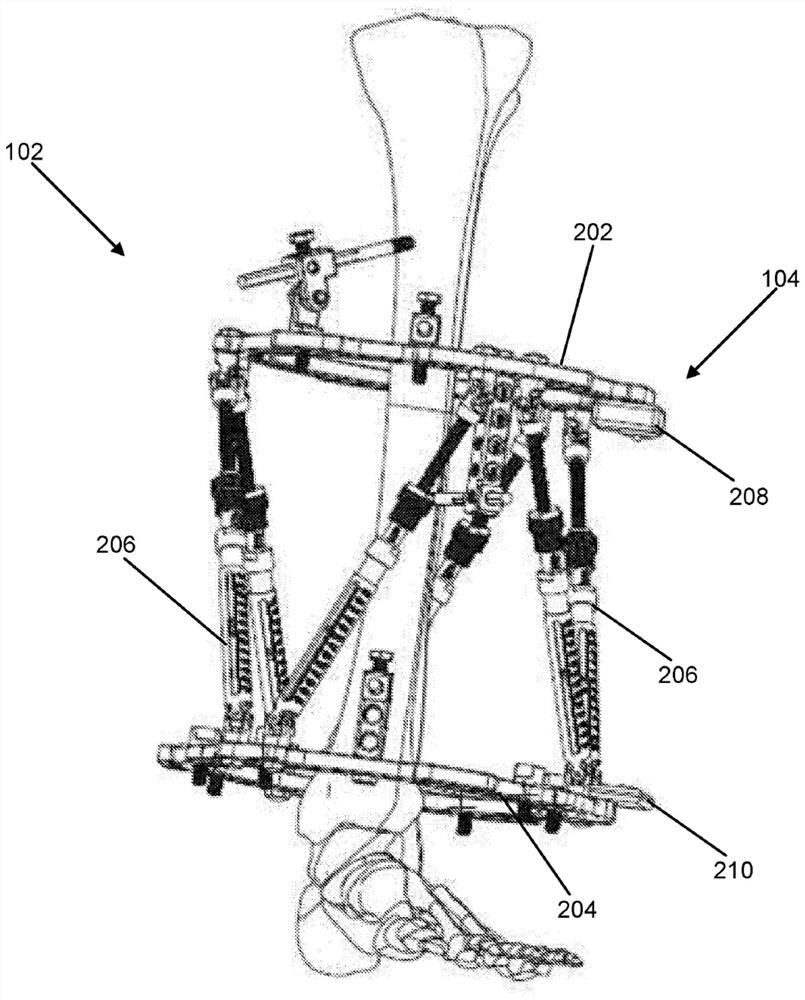 Devices, software, systems, and methods for intraoperatively and postoperatively tracking the relative position between external fixation components or rings