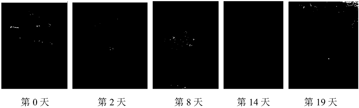 Recombinant collagen hydrogel wound dressing and preparation method and application thereof