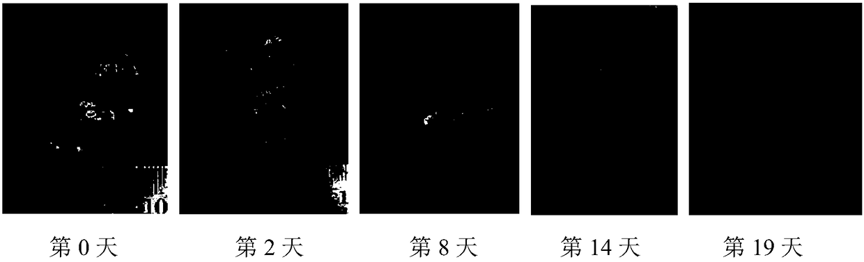 Recombinant collagen hydrogel wound dressing and preparation method and application thereof