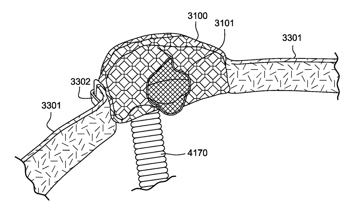 Textile patient interface