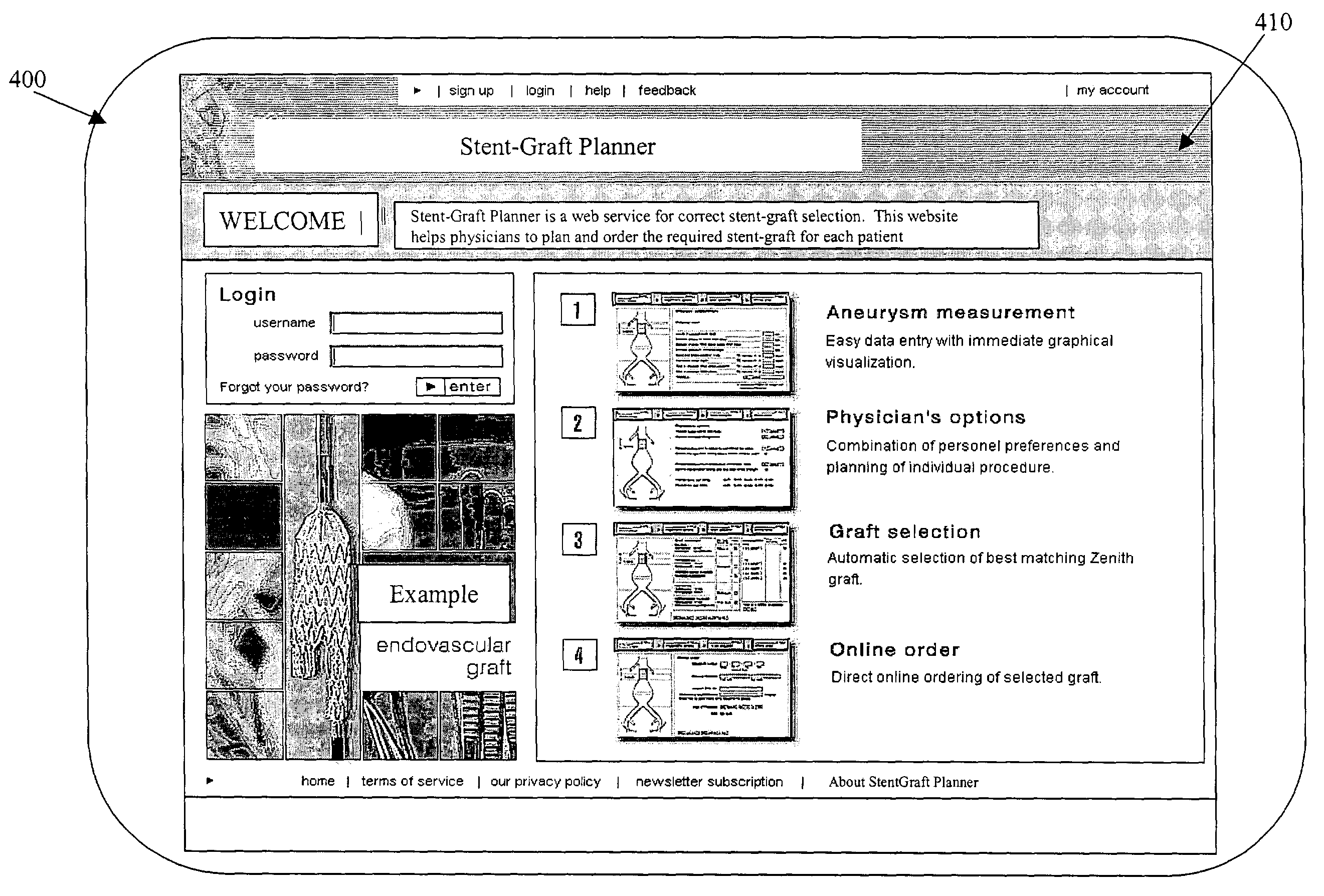 Computer-based methods and structures for stent-graft selection