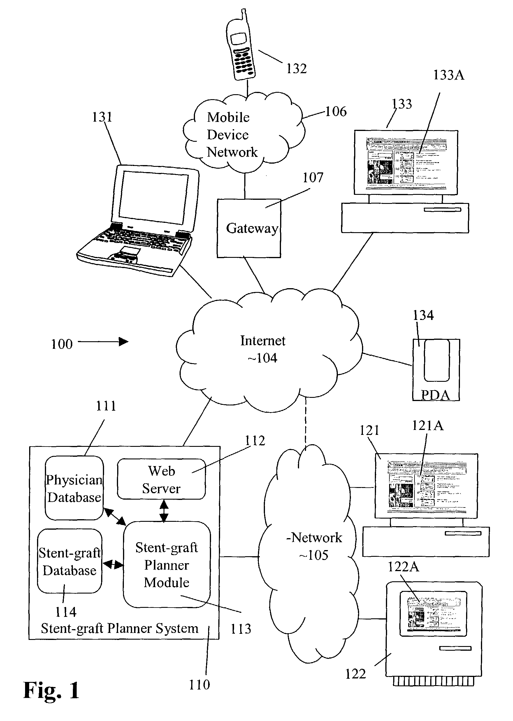 Computer-based methods and structures for stent-graft selection