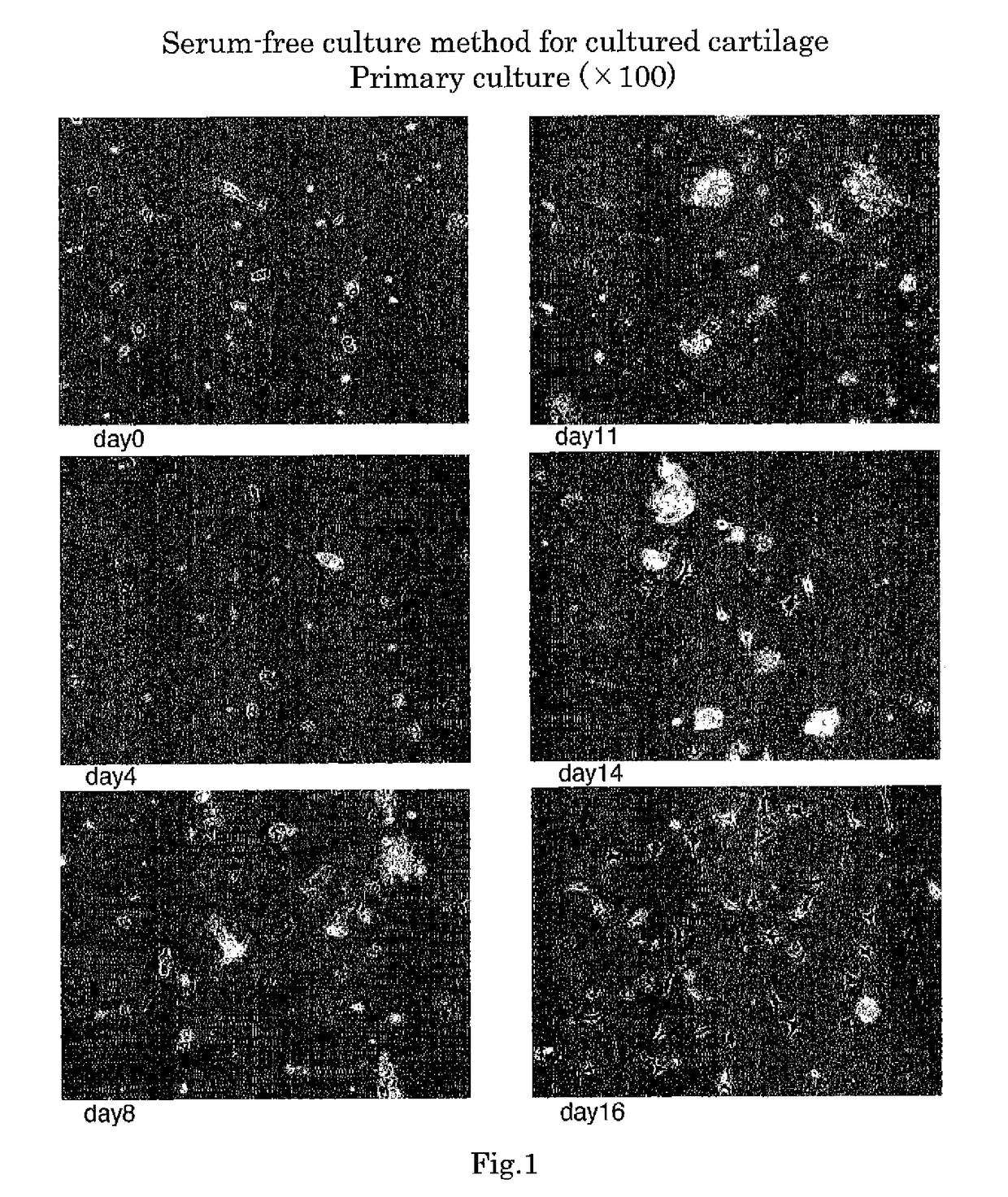 Method for serum-free culture of chondrocytes and serum-free culture medium