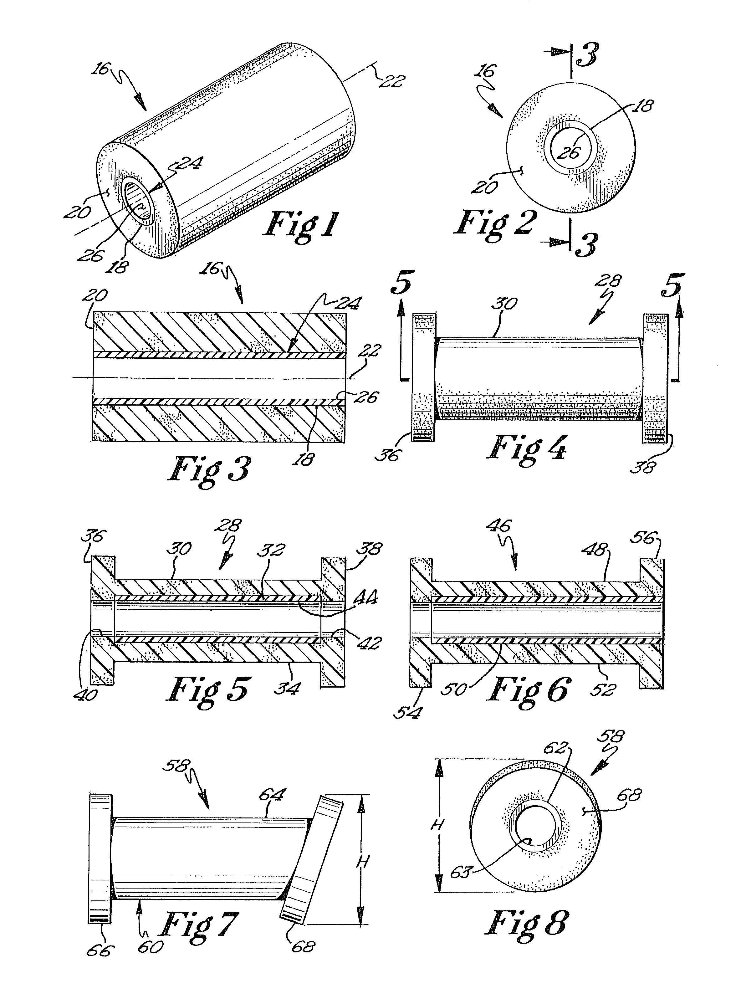 Biodegradable prosthesis