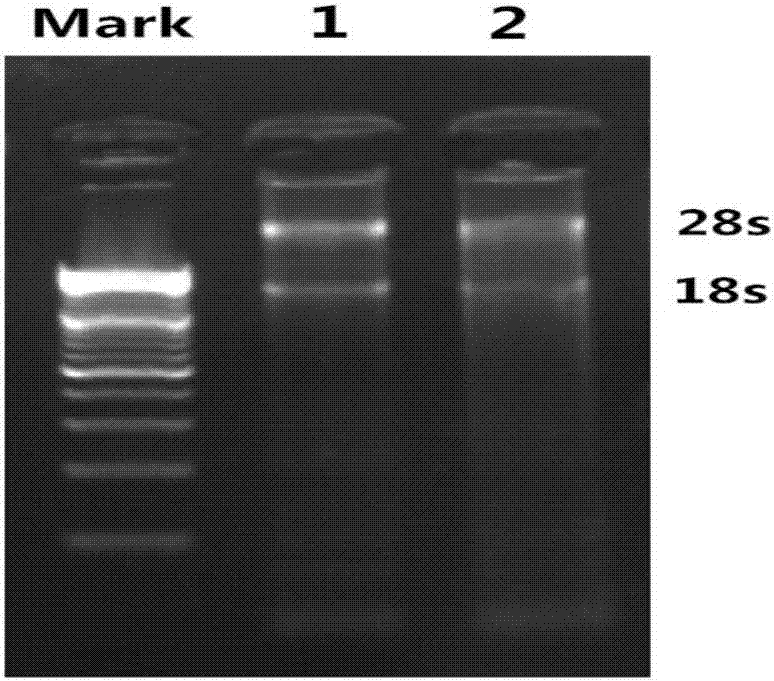 Applications of BCG-PSN (BCG-polysaccharide nuceic acid) in promoting proliferation of CIK cells (cytokine-induced killer cells) and in improving anti-tumor activity of CIK cells