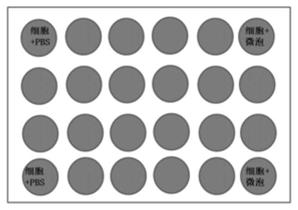 Application of microbubble-combined ultrasound intervention in improving receptivity of thin-type endometrium