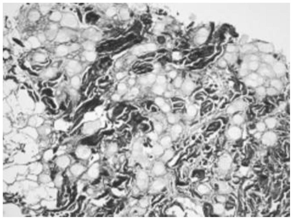 Casein calcium phosphorus microsphere collagen filling agent, preparation method of filling agent and preparation method of casein calcium phosphorus microspheres