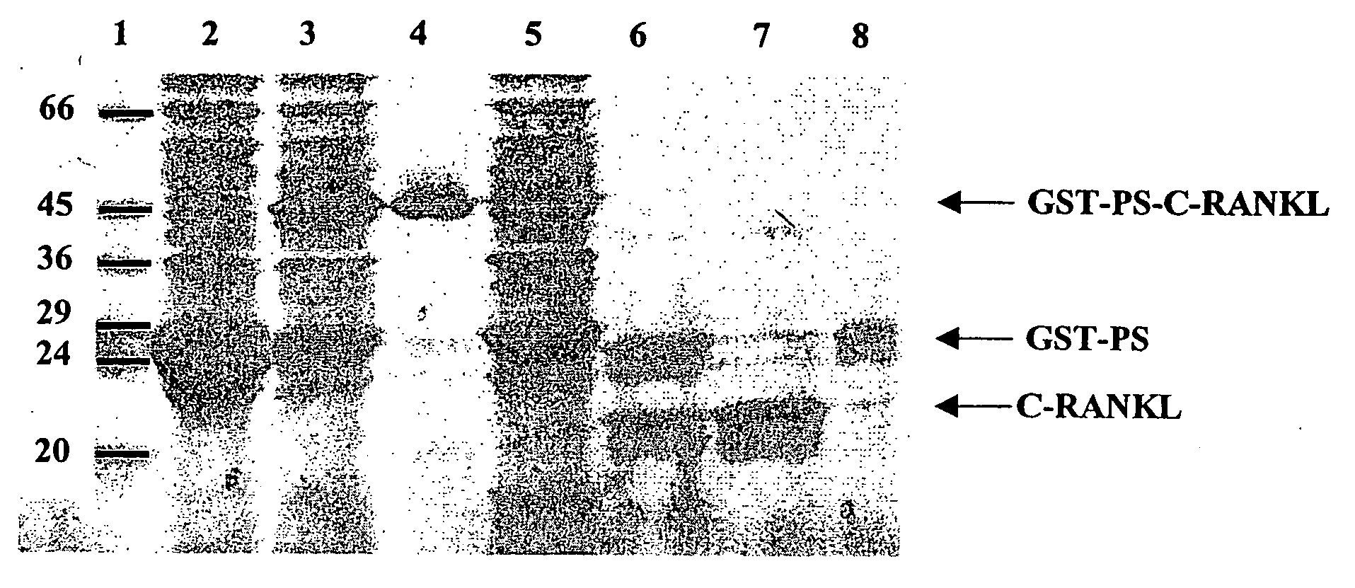 Antigen arrays for treatment of bone disease