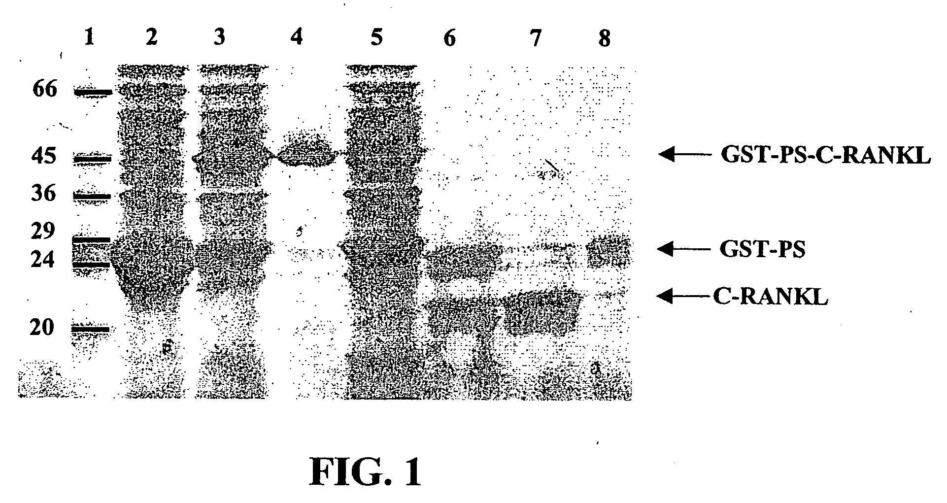 Antigen arrays for treatment of bone disease