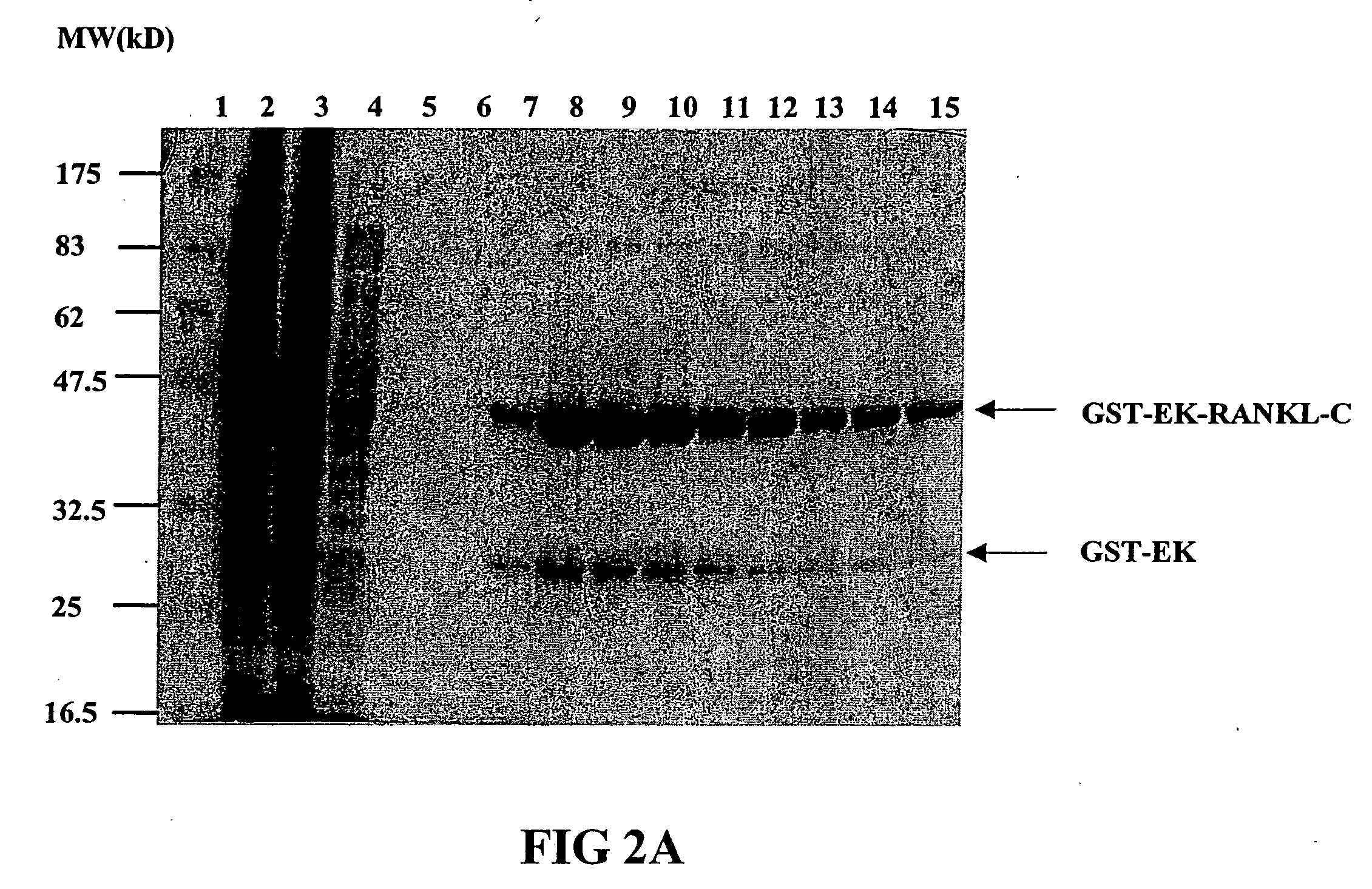 Antigen arrays for treatment of bone disease