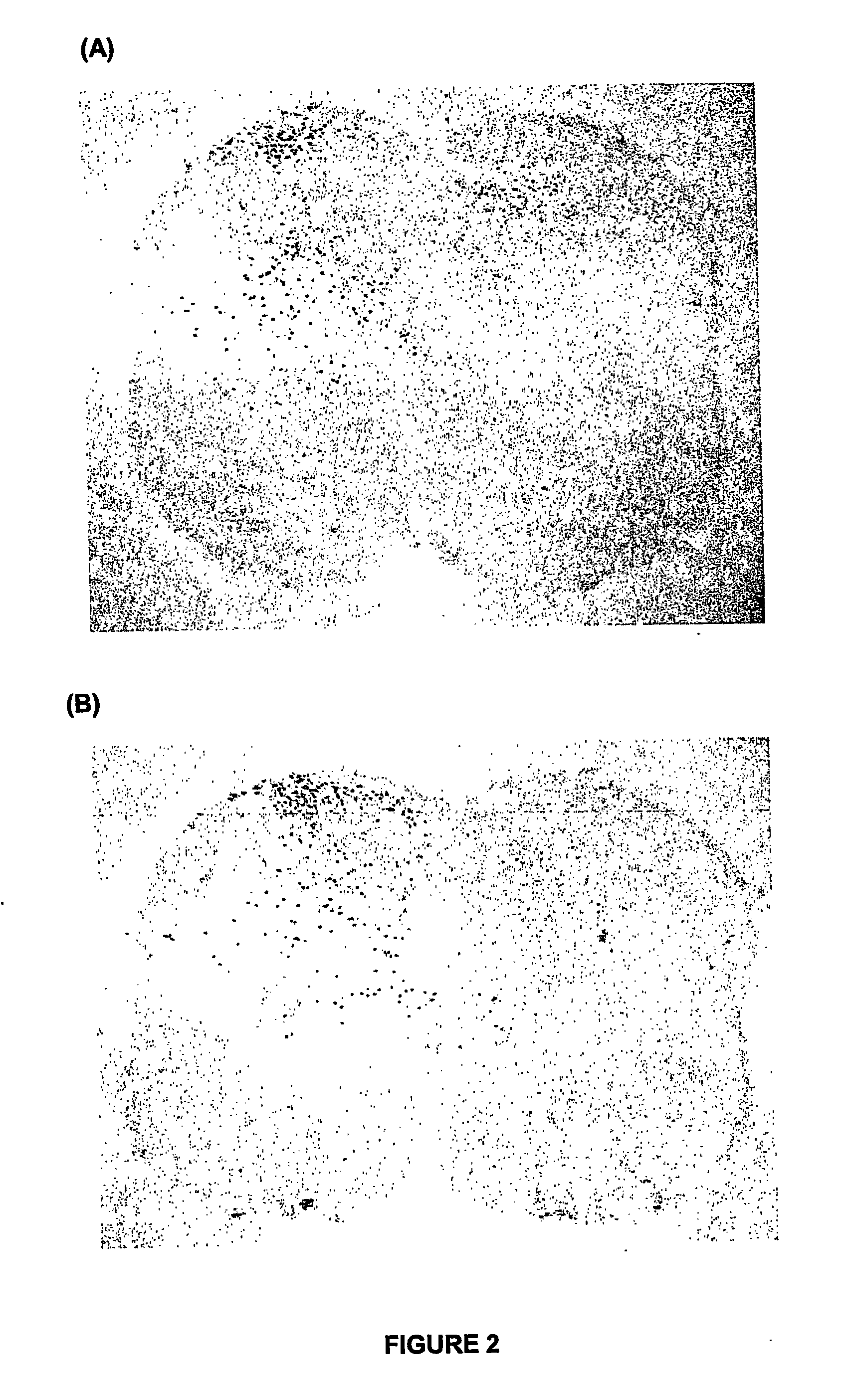 Analgesic agent for newborn or fetal subjects