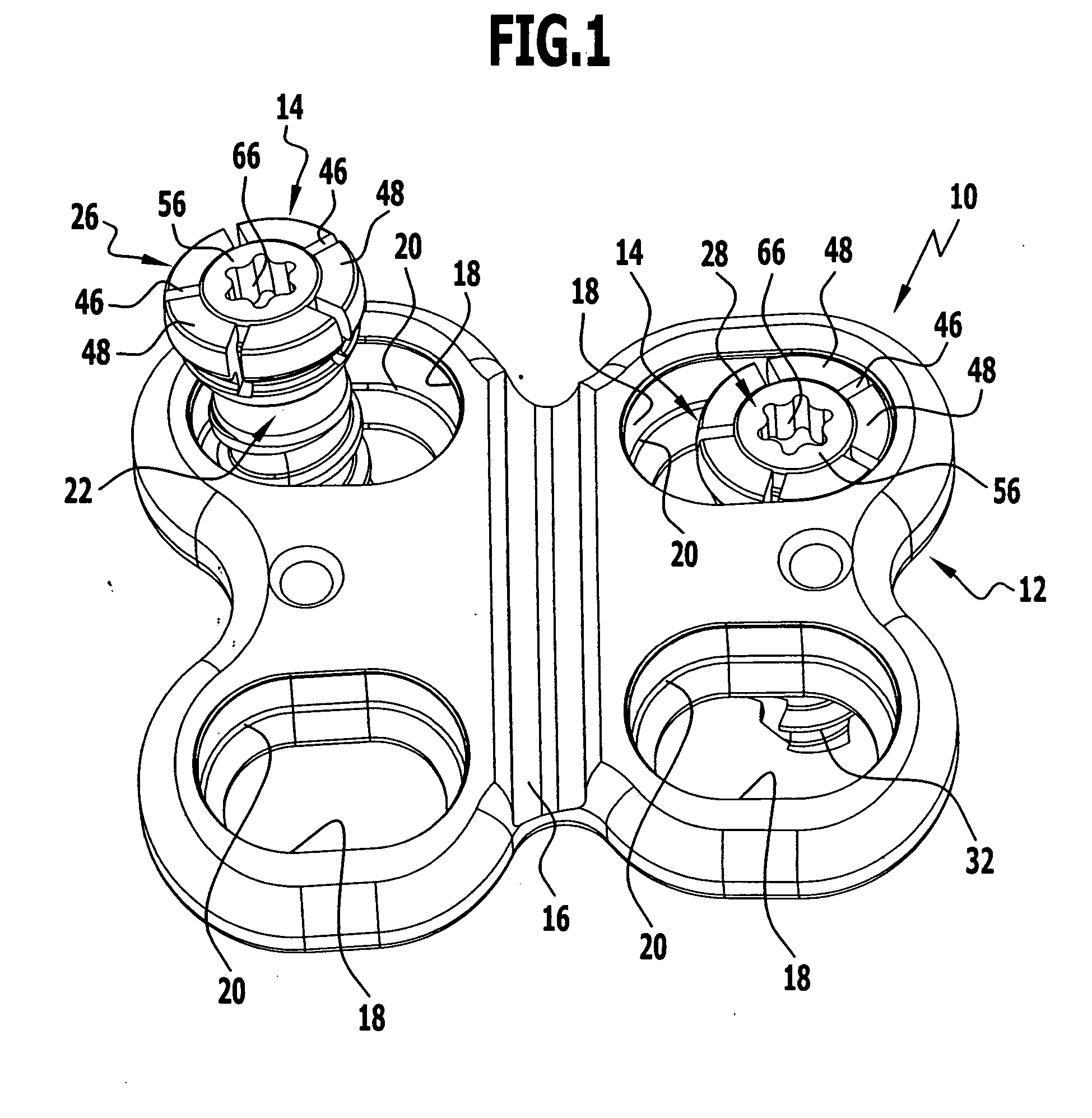 Bone Screw