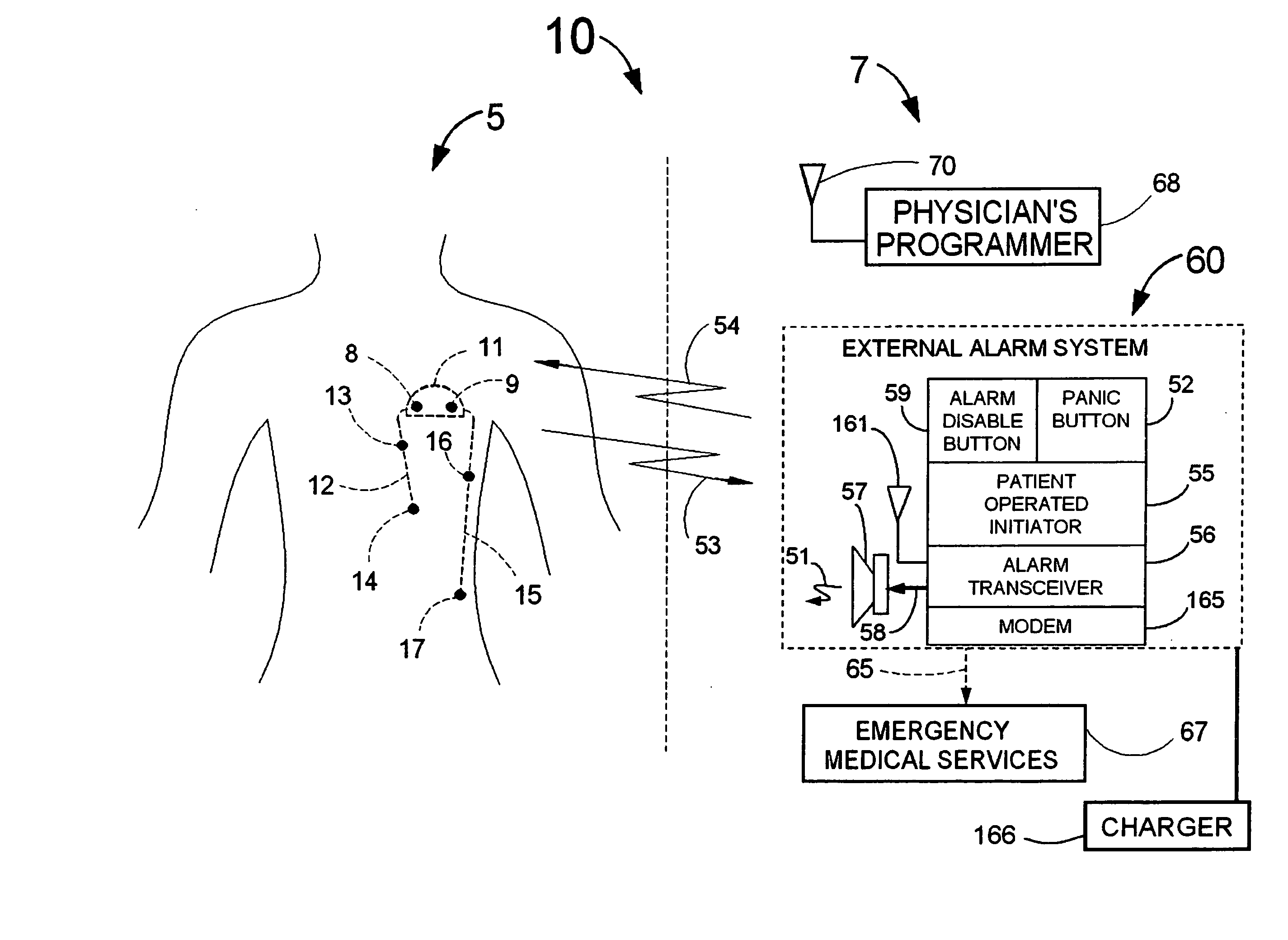 Means and method for the detection of cardiac events