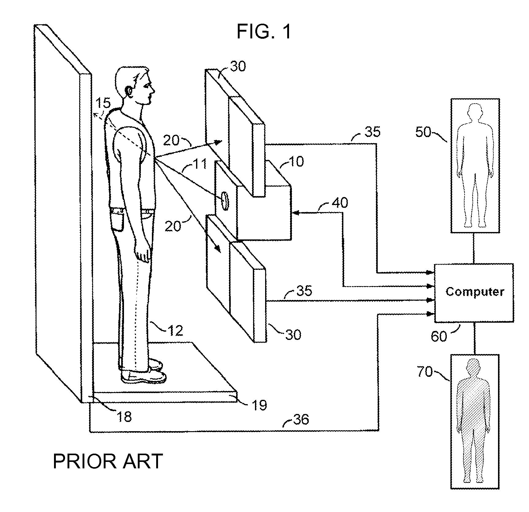 X-ray Shoe Inspection