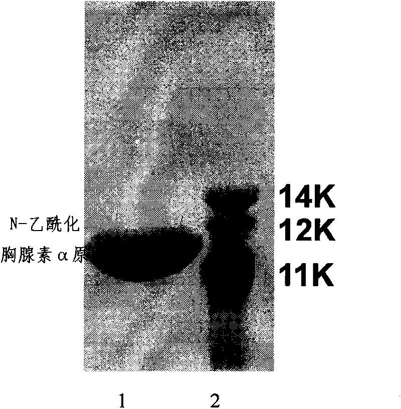 Method for preparing genetic engineering N-acetylated thymosin alpha1