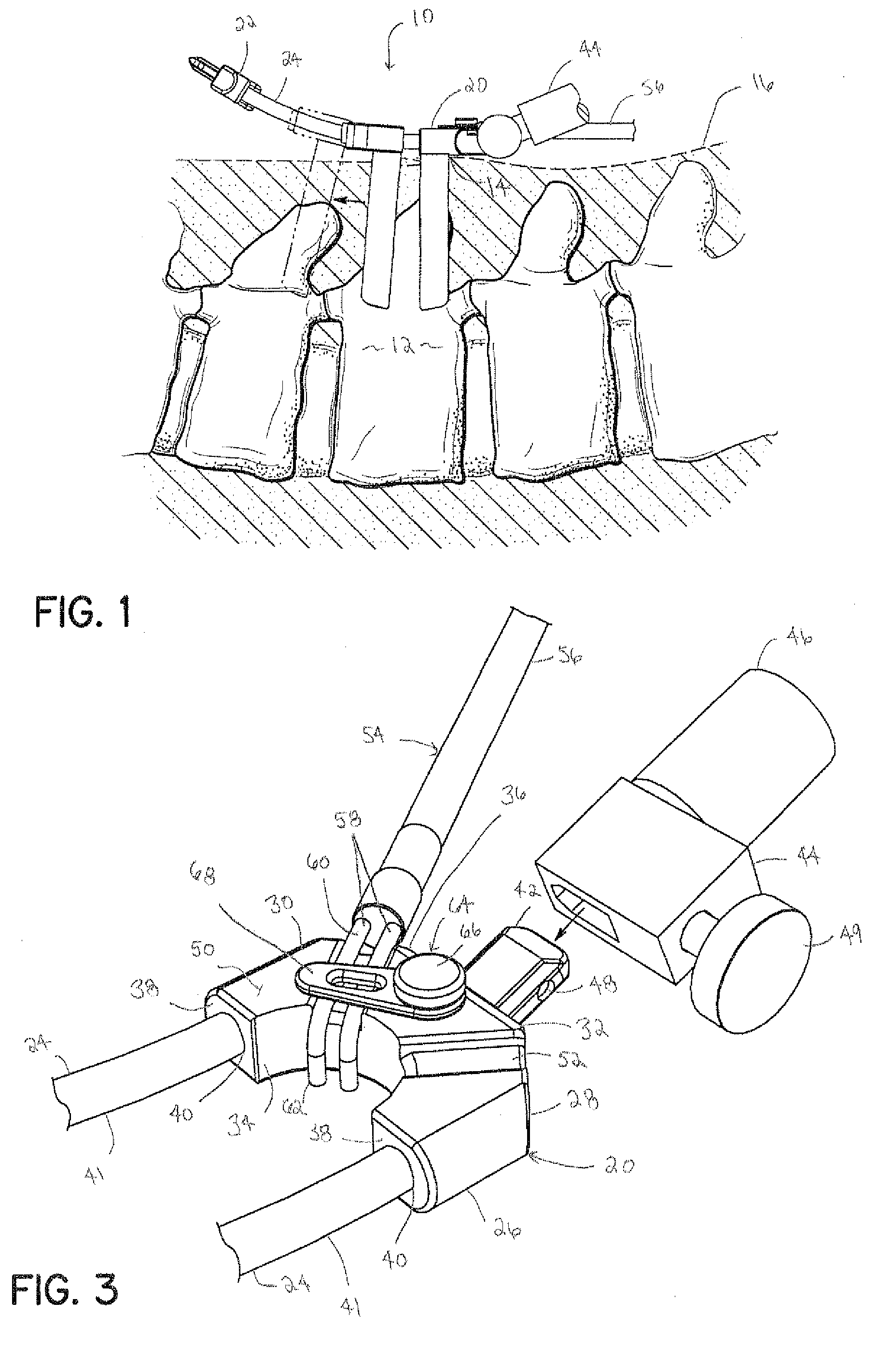 Surgical access system and method of using the same