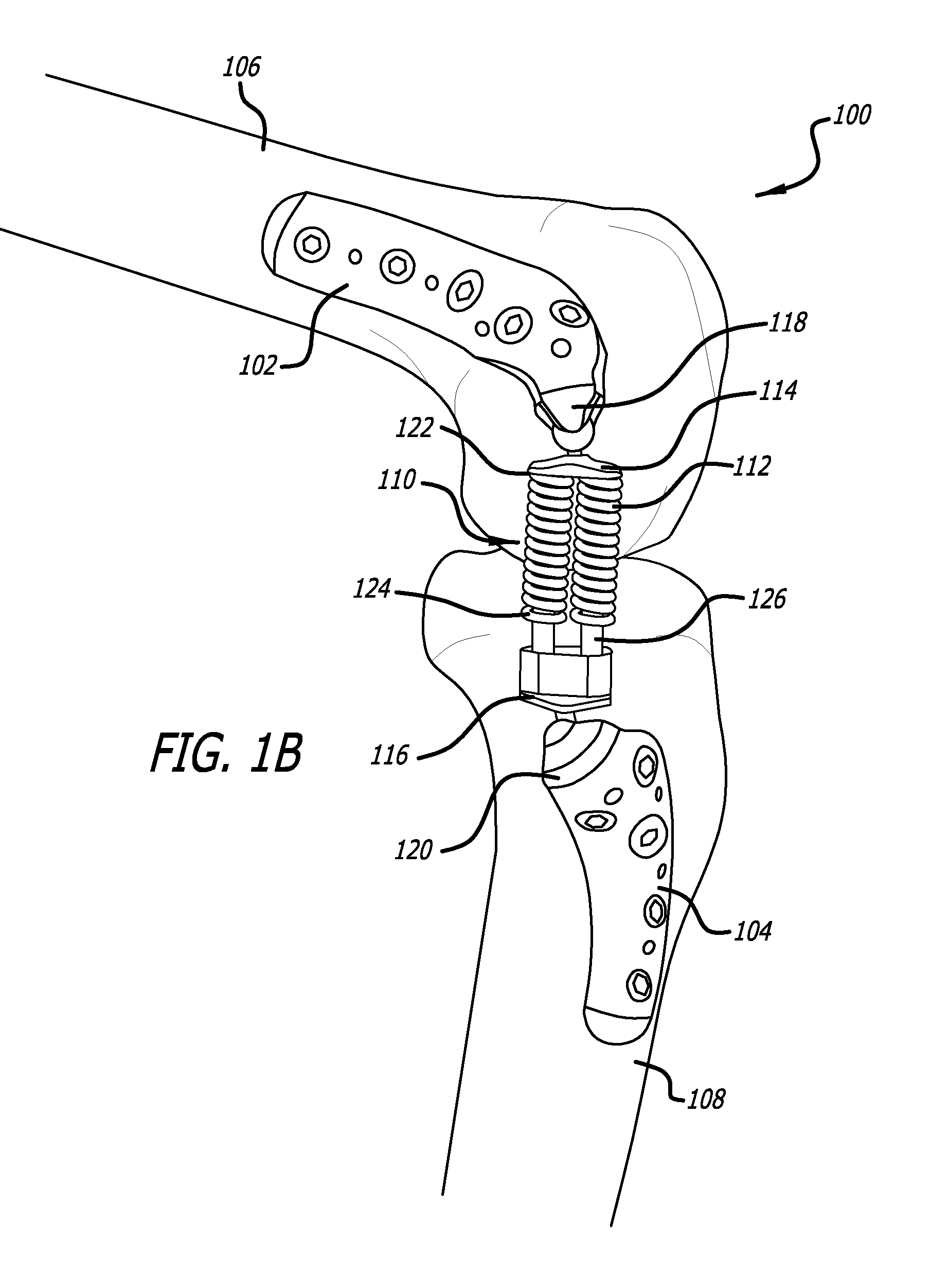 Adjustable Absorber Designs For Implantable Device