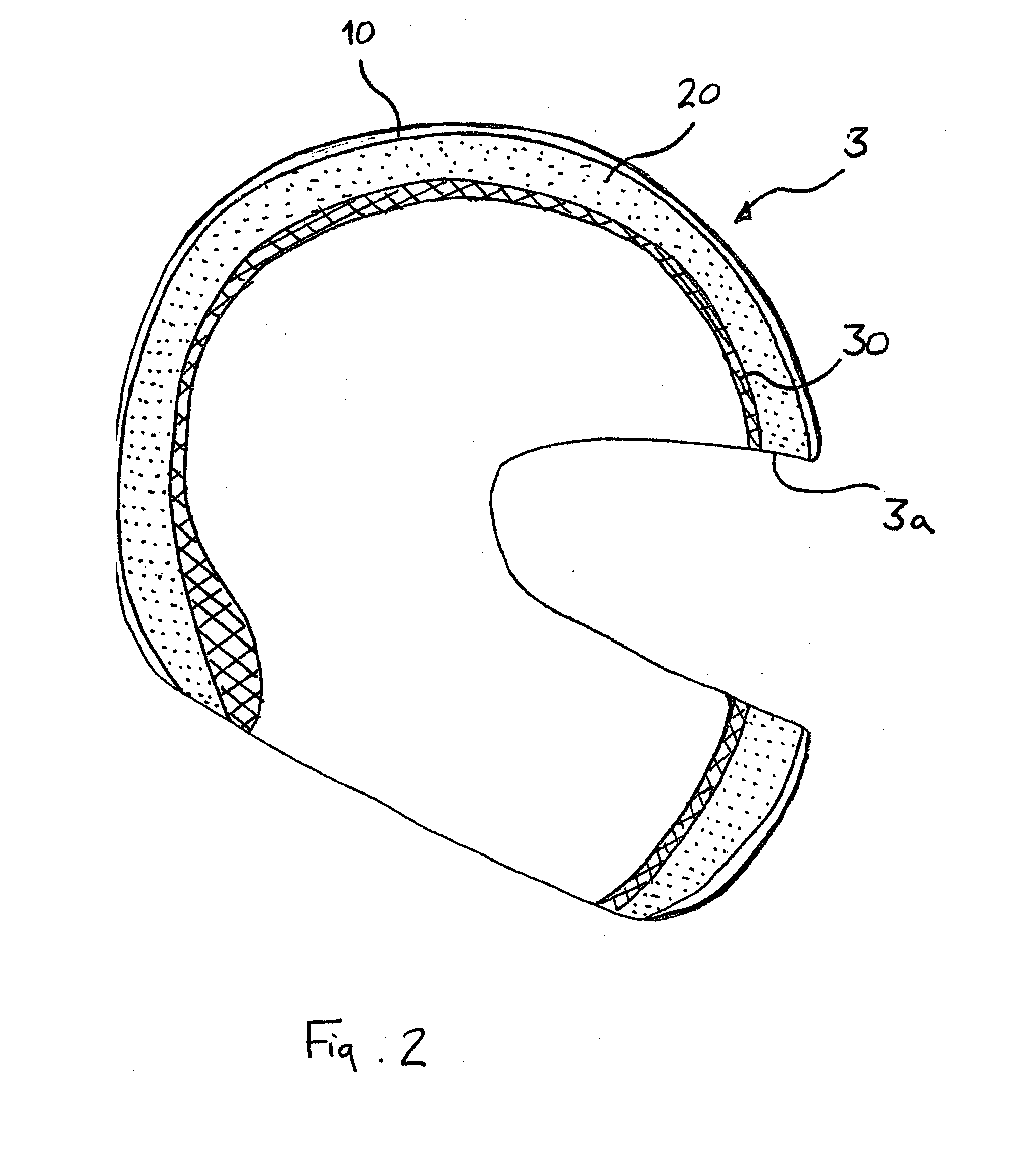 Brain cooling device