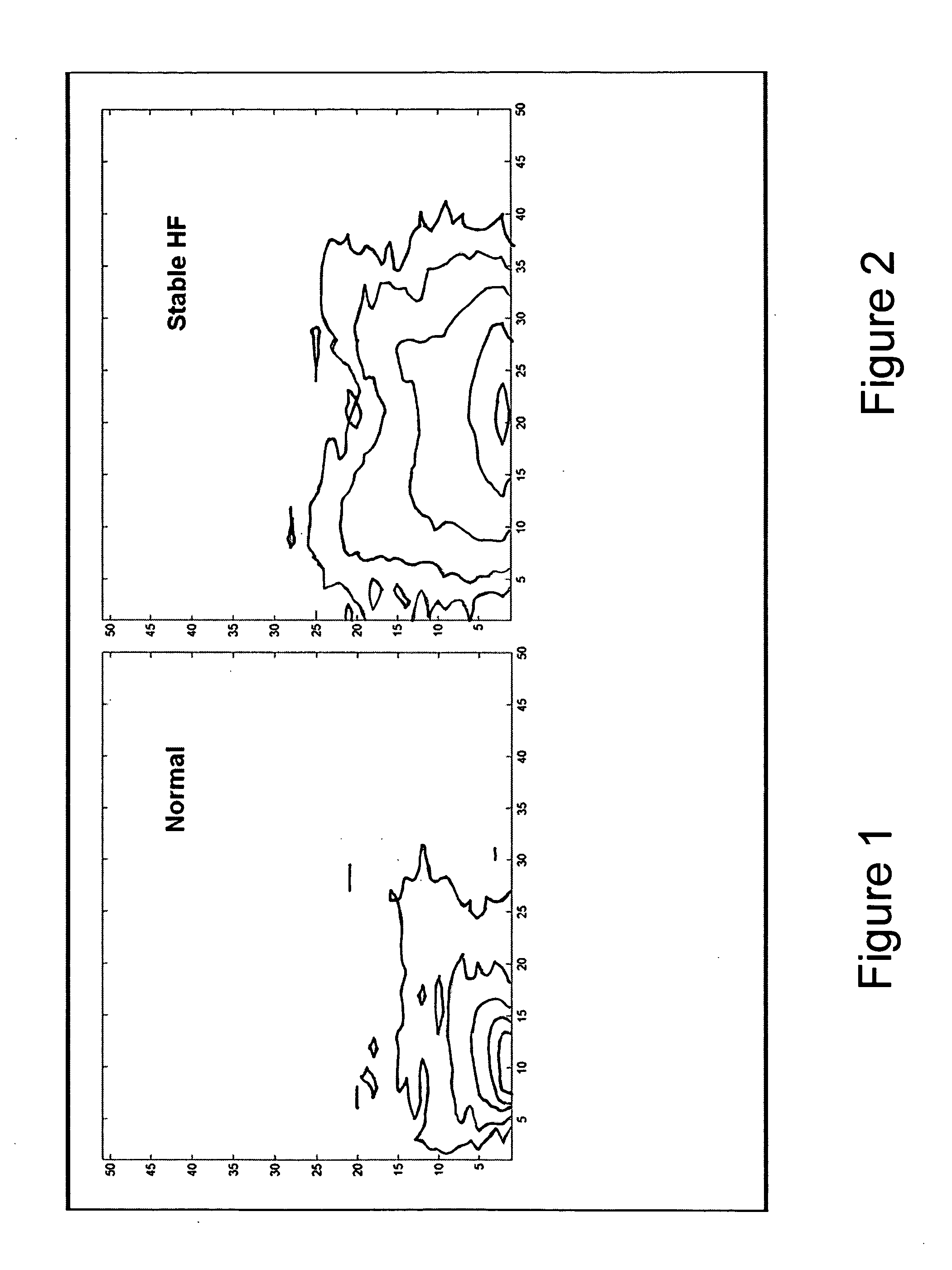 Respiration monitoring using respiration rate variability