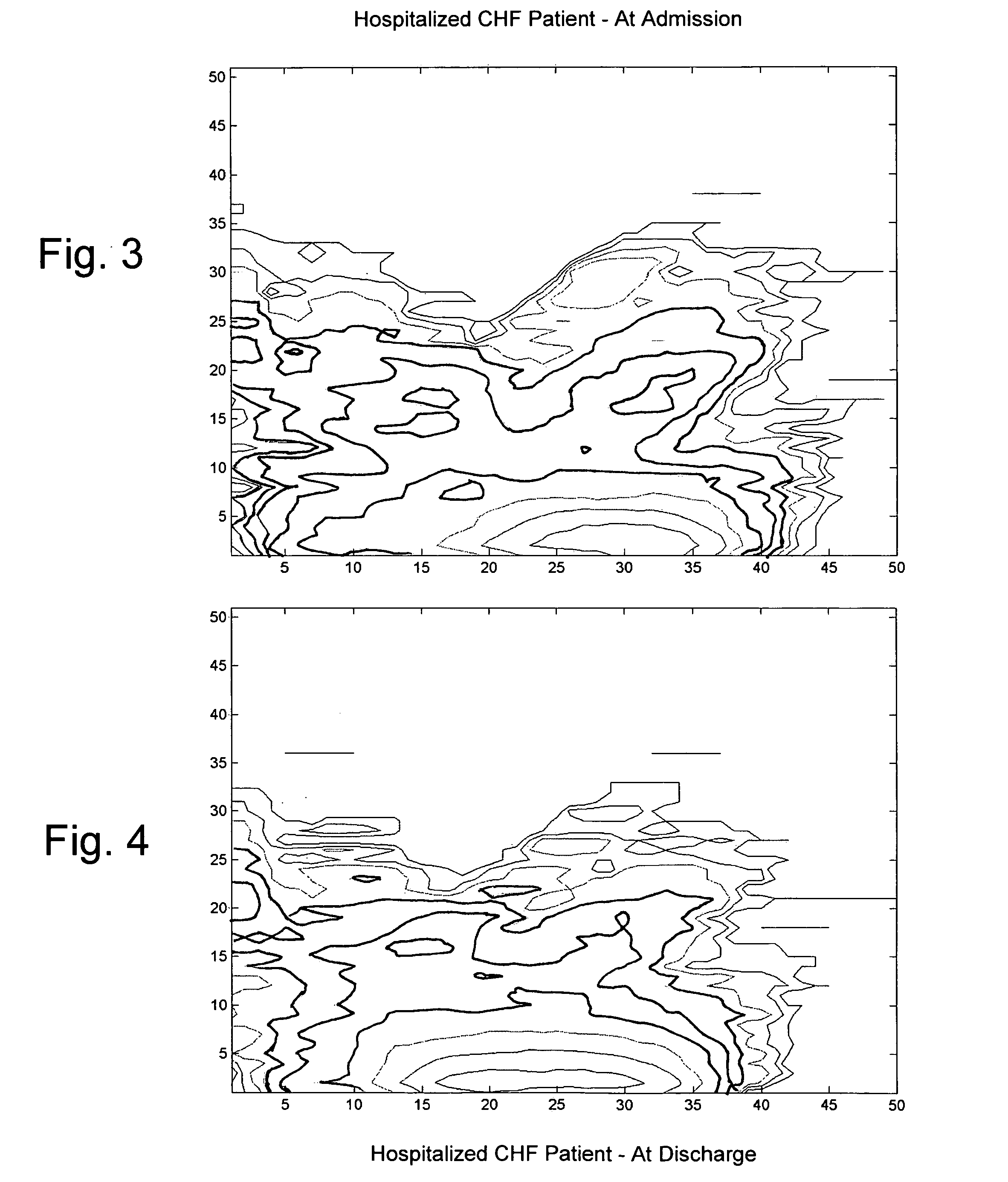 Respiration monitoring using respiration rate variability