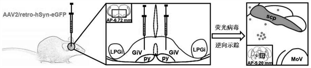 Experimental method for determining anatomo-functional delimitation of sublaterodorsal tegmental nucleus (SLD)