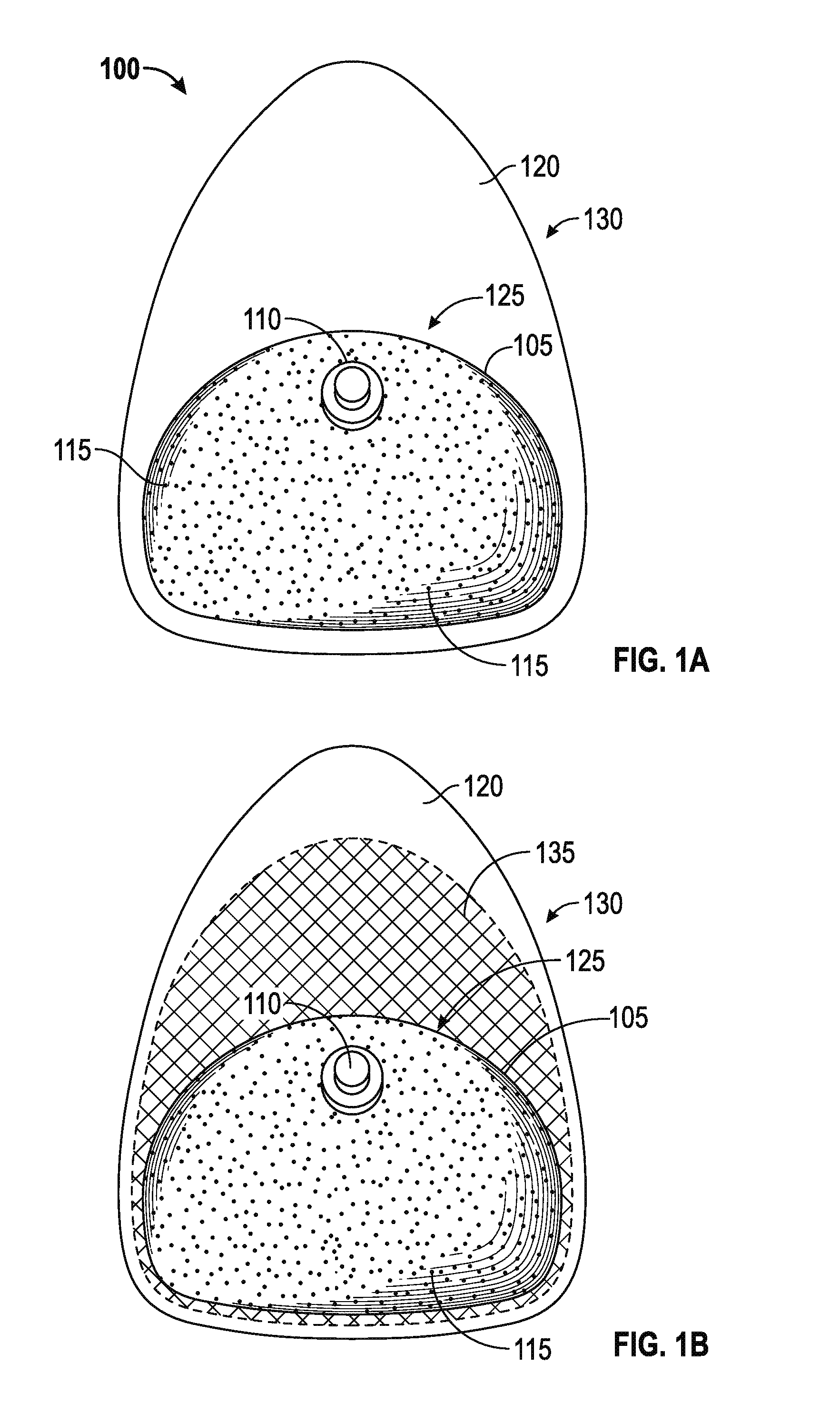 Systems and methods for a tissue expander