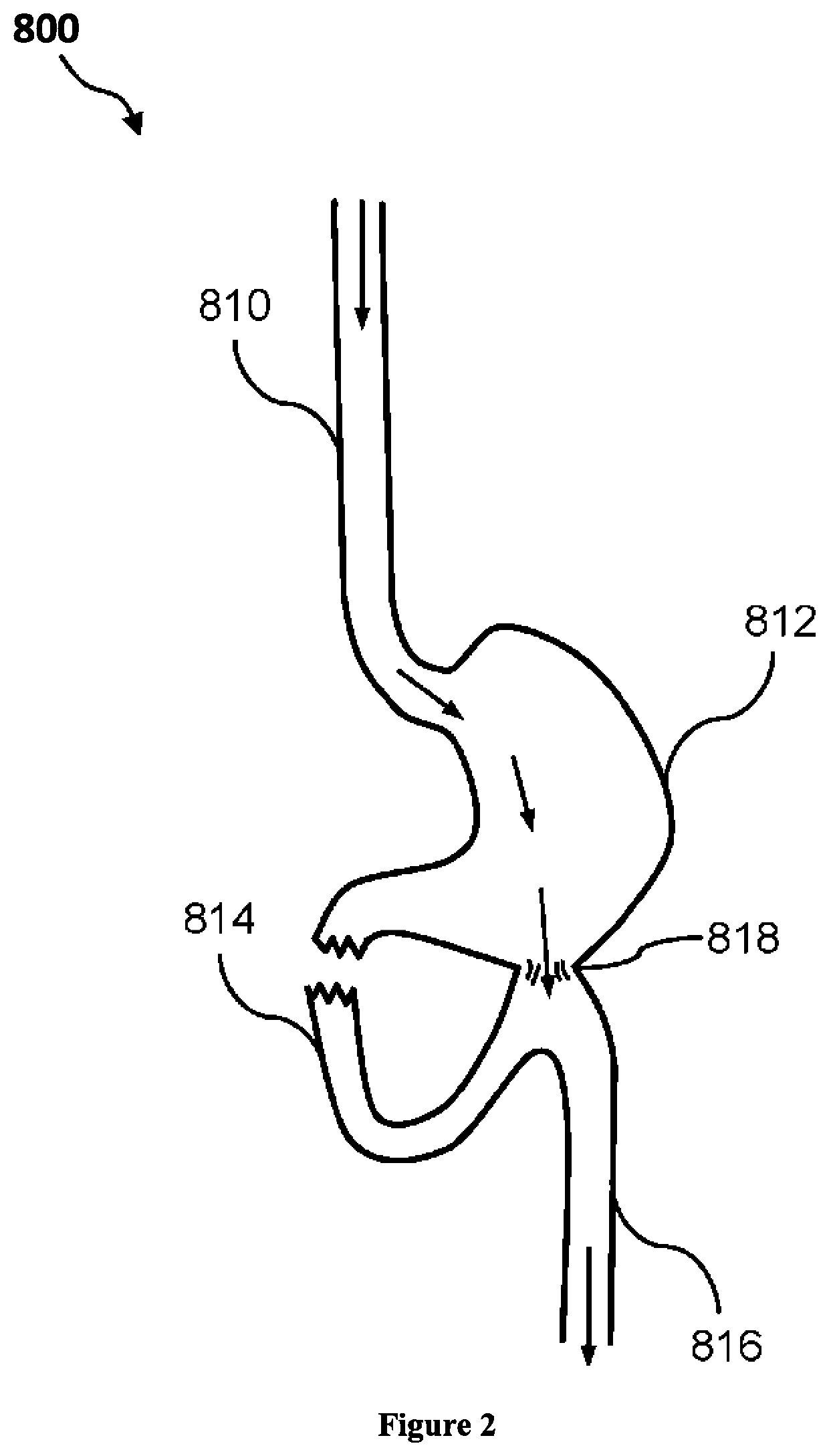 Composition and method for treatment of metabolic disorders