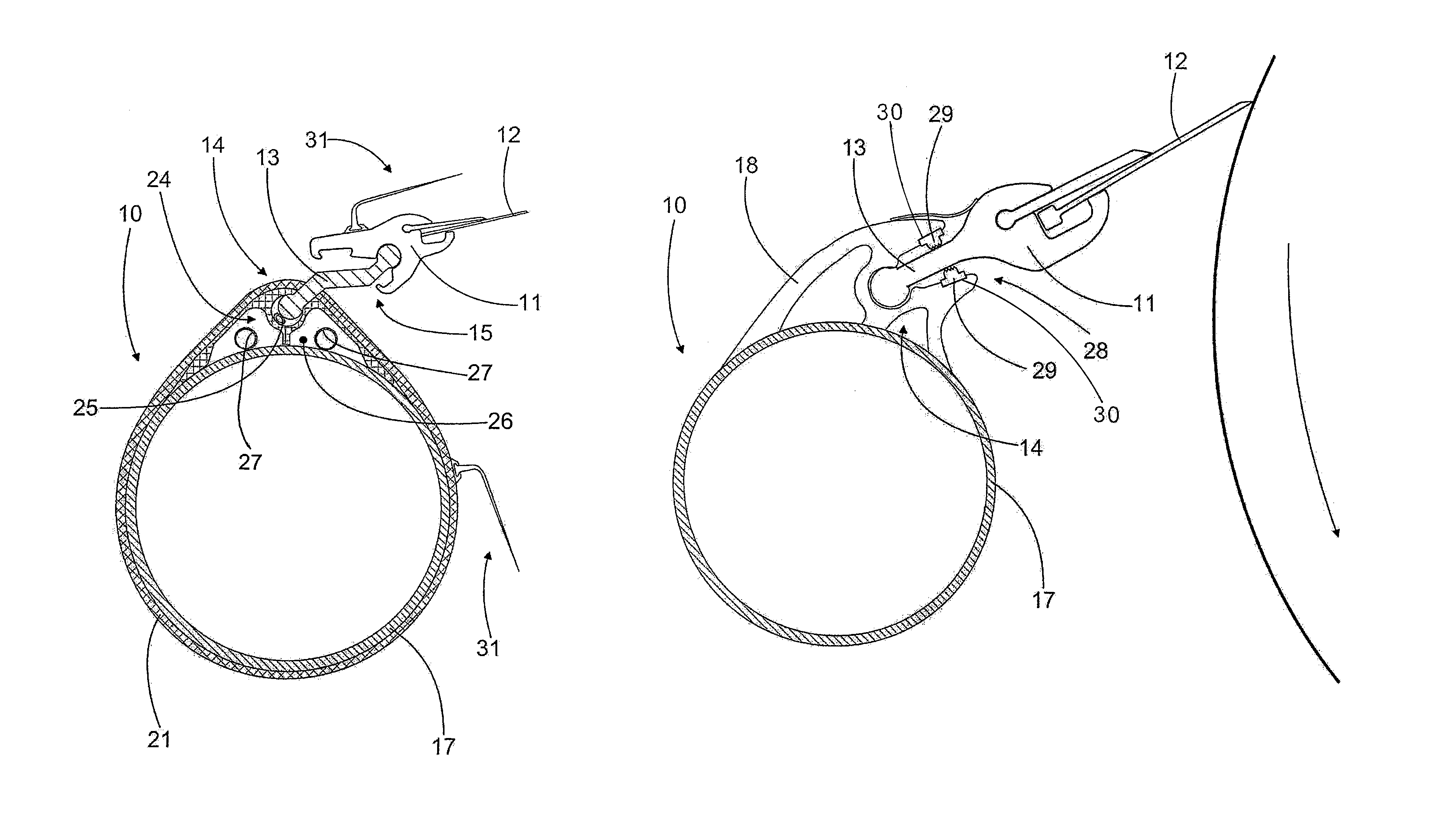 Composite doctor arrangement