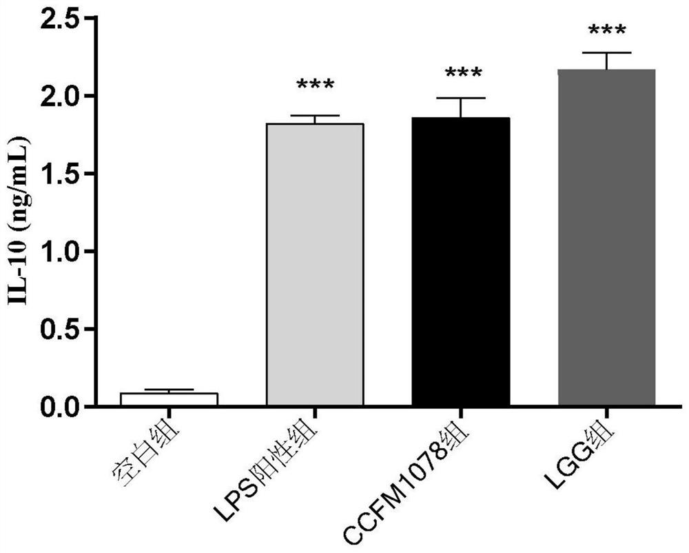 A strain of Bifidobacterium breve that can relieve rheumatoid arthritis and its application