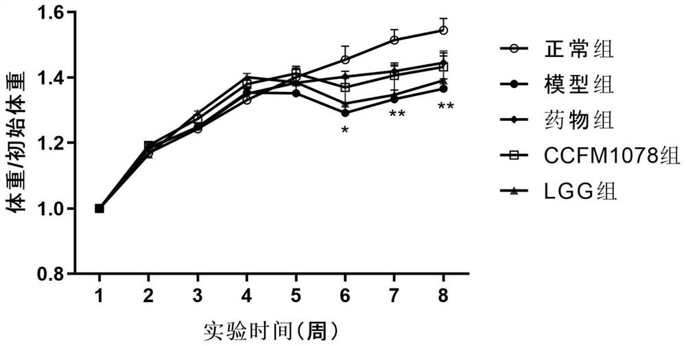 A strain of Bifidobacterium breve that can relieve rheumatoid arthritis and its application