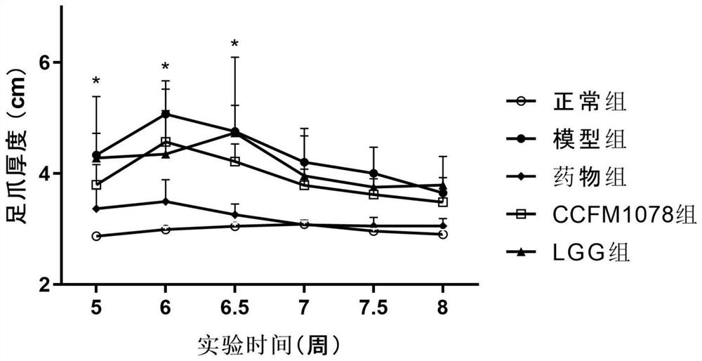 A strain of Bifidobacterium breve that can relieve rheumatoid arthritis and its application