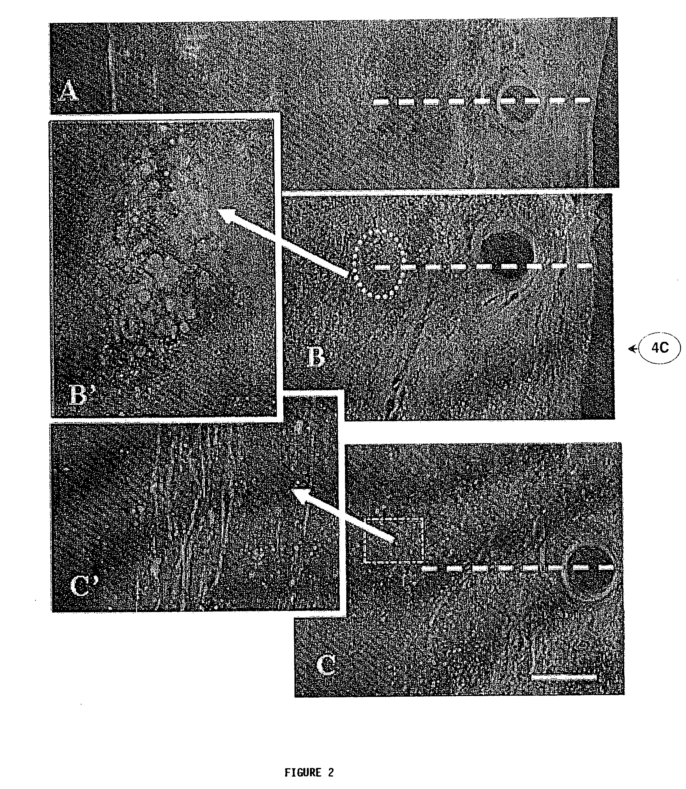 Method of treatment for central nervous system injury