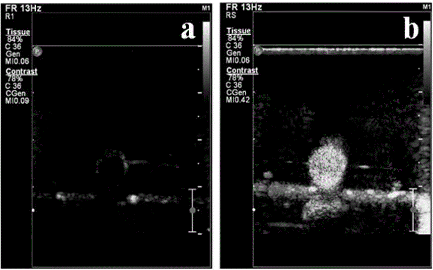 Ultrasonic/magnetic resonance bimodal contrast agent and its preparation method and use