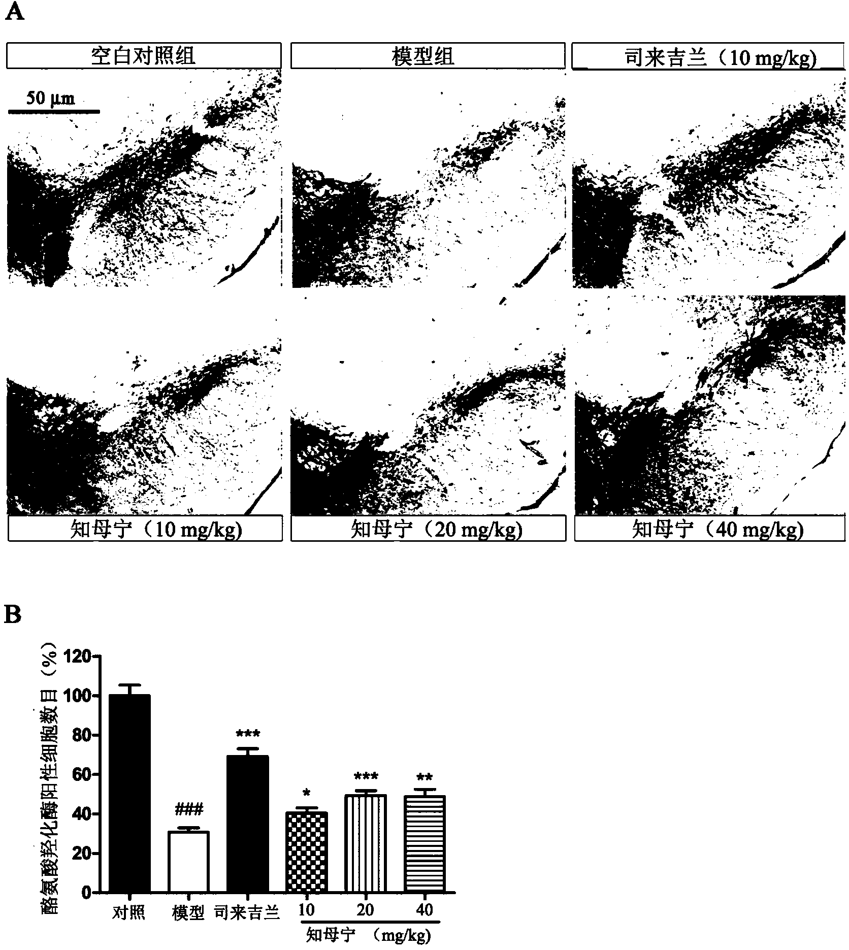 Purpose of asphonin in preparation of medicine for treating Parkinson's disease