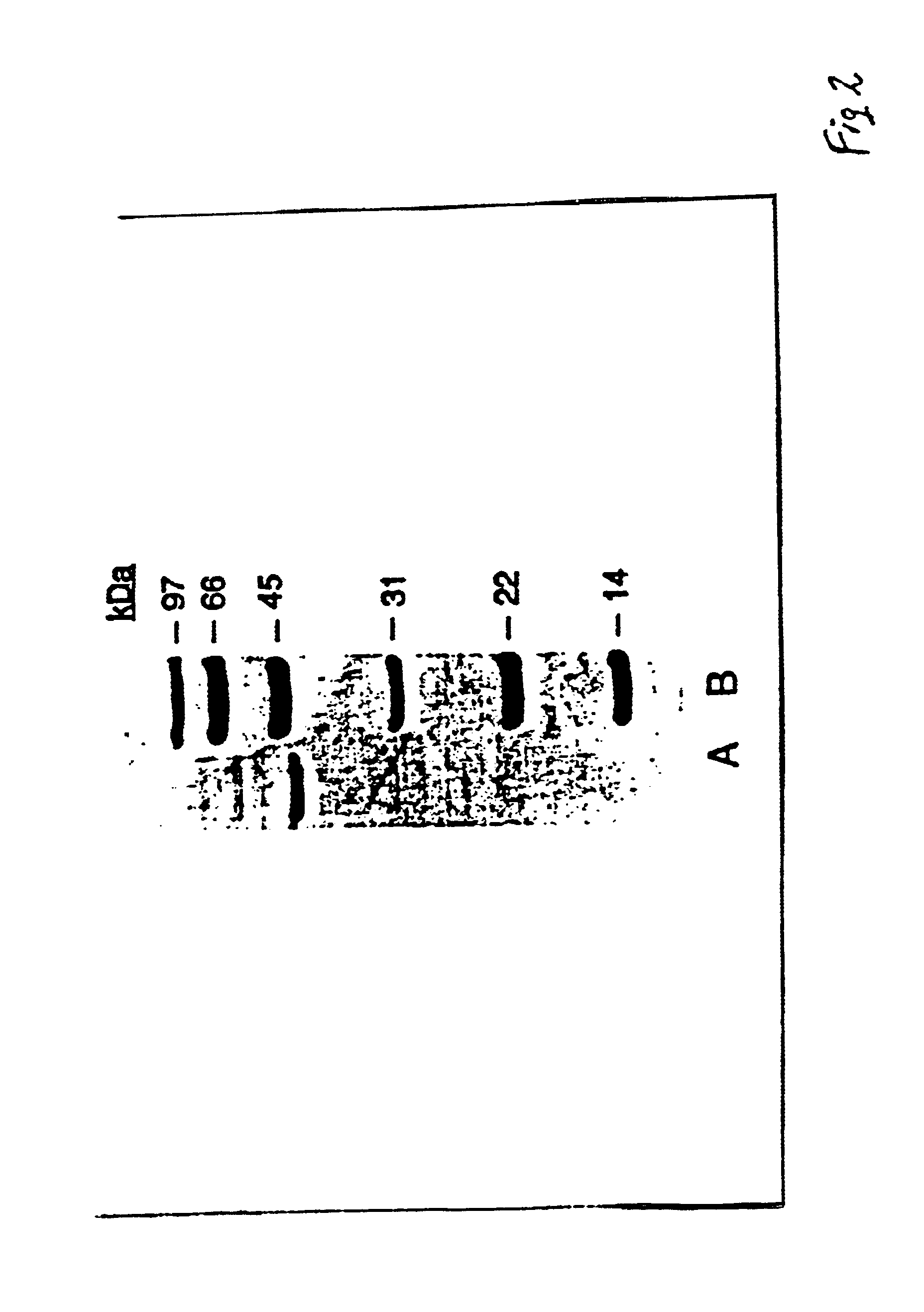 Sialidase and recombinant cell lines