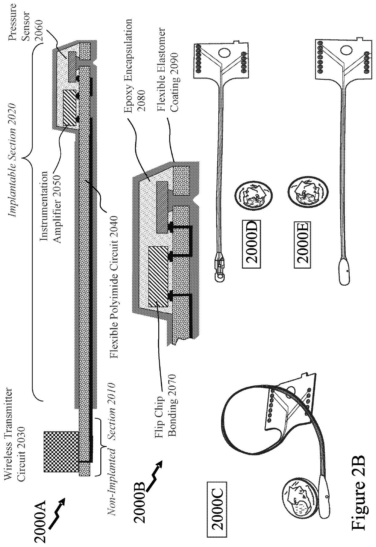 Methods and systems relating to biological systems with embedded mems sensors