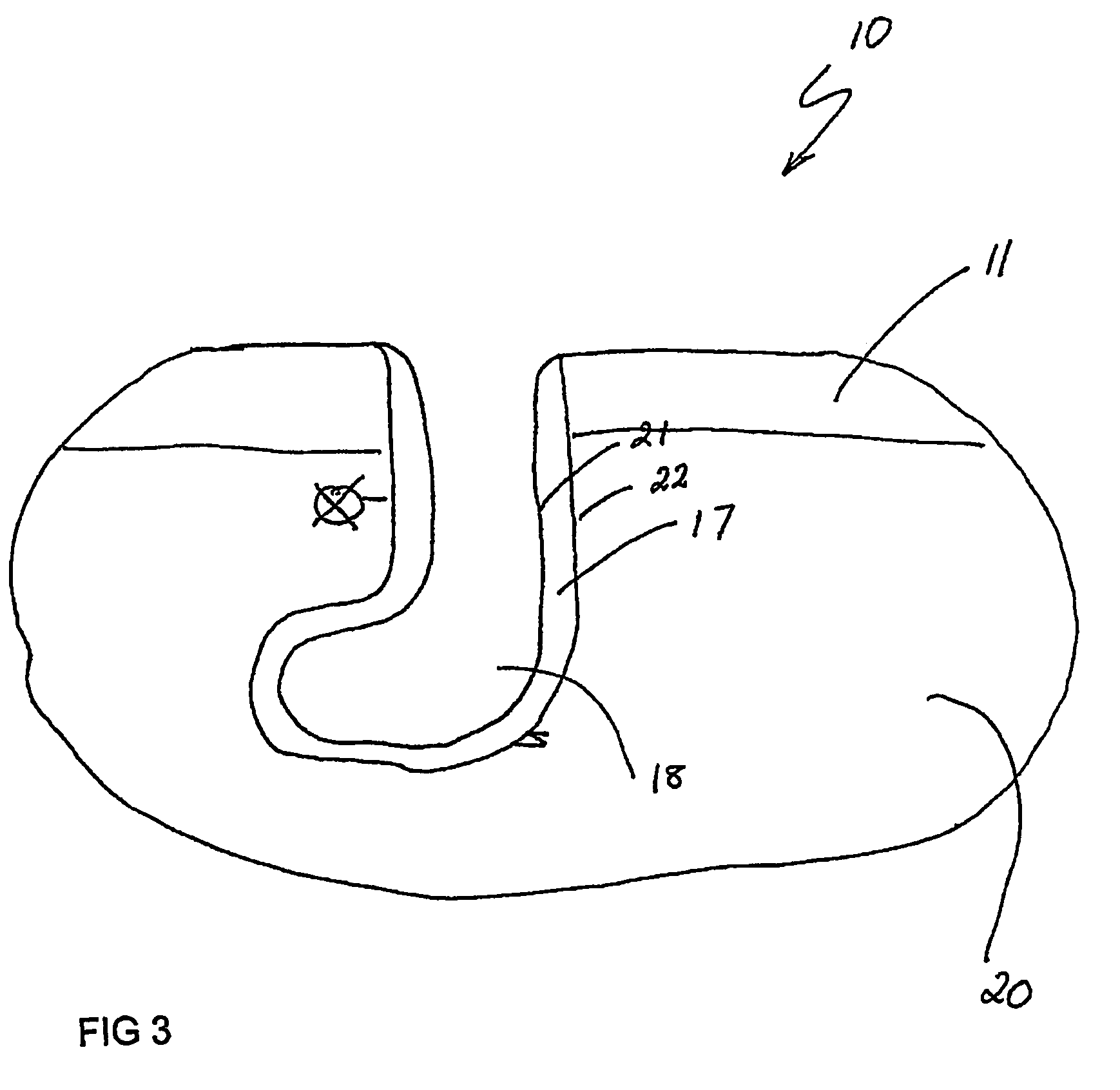 Hydrotherapy Apparatus for a Lower Extremity