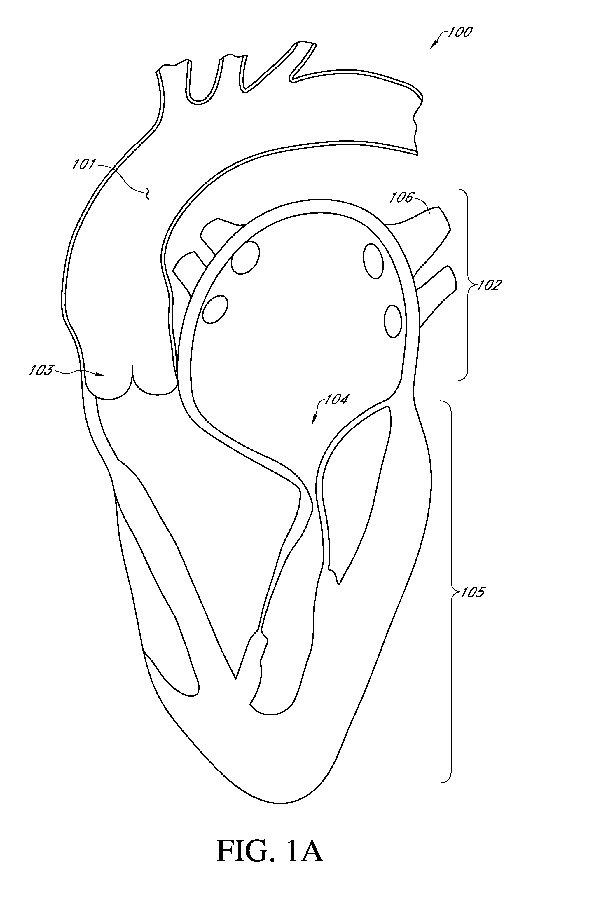 Prosthetic mitral valve with adjustable support