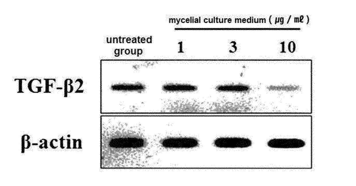 Composition for preventing alopecia or stimulating hair growth containing extracellular polysaccharide produced from ceriporia lacerata as active ingredient