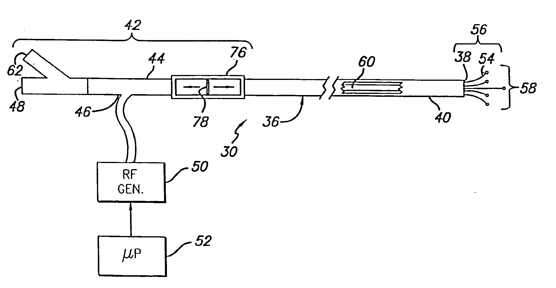 Method and apparatus for applying energy to biological tissue including the use of tumescent tissue compression