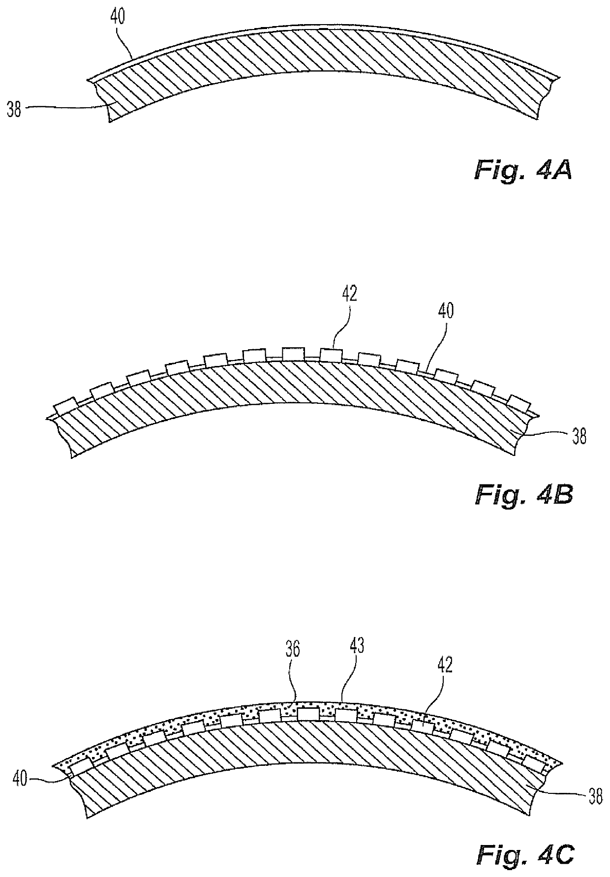 Balloon with radiopaque adhesive