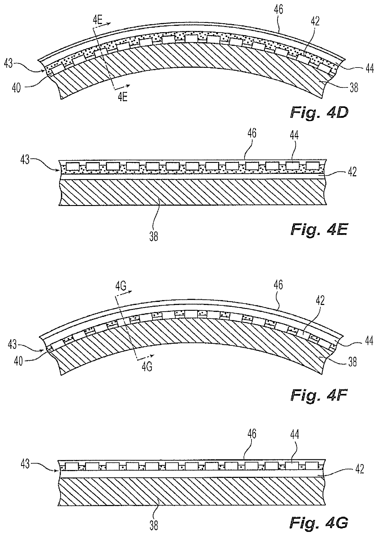 Balloon with radiopaque adhesive