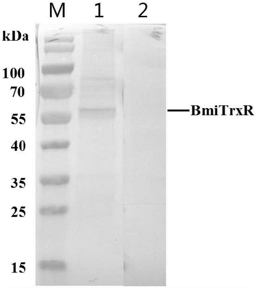 Babesia microti thioredoxin reductase molecule, and gene and applications thereof