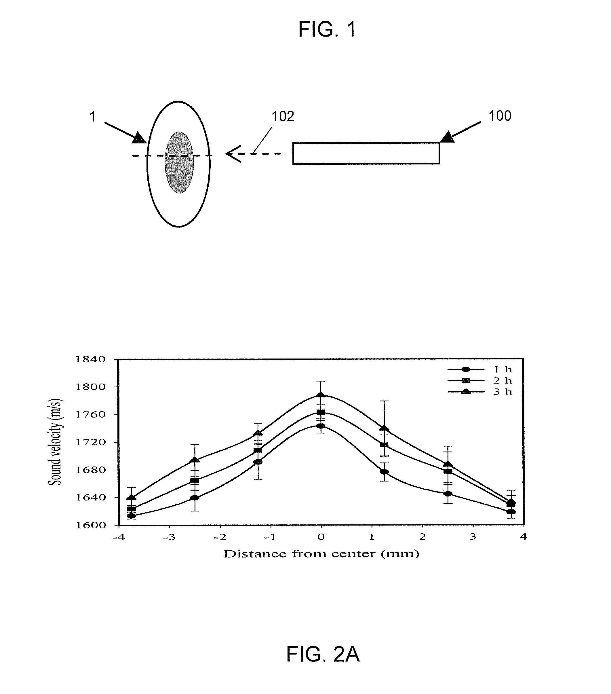 Preoperative and Intra-Operative Lens Hardness Measurement by Ultrasound