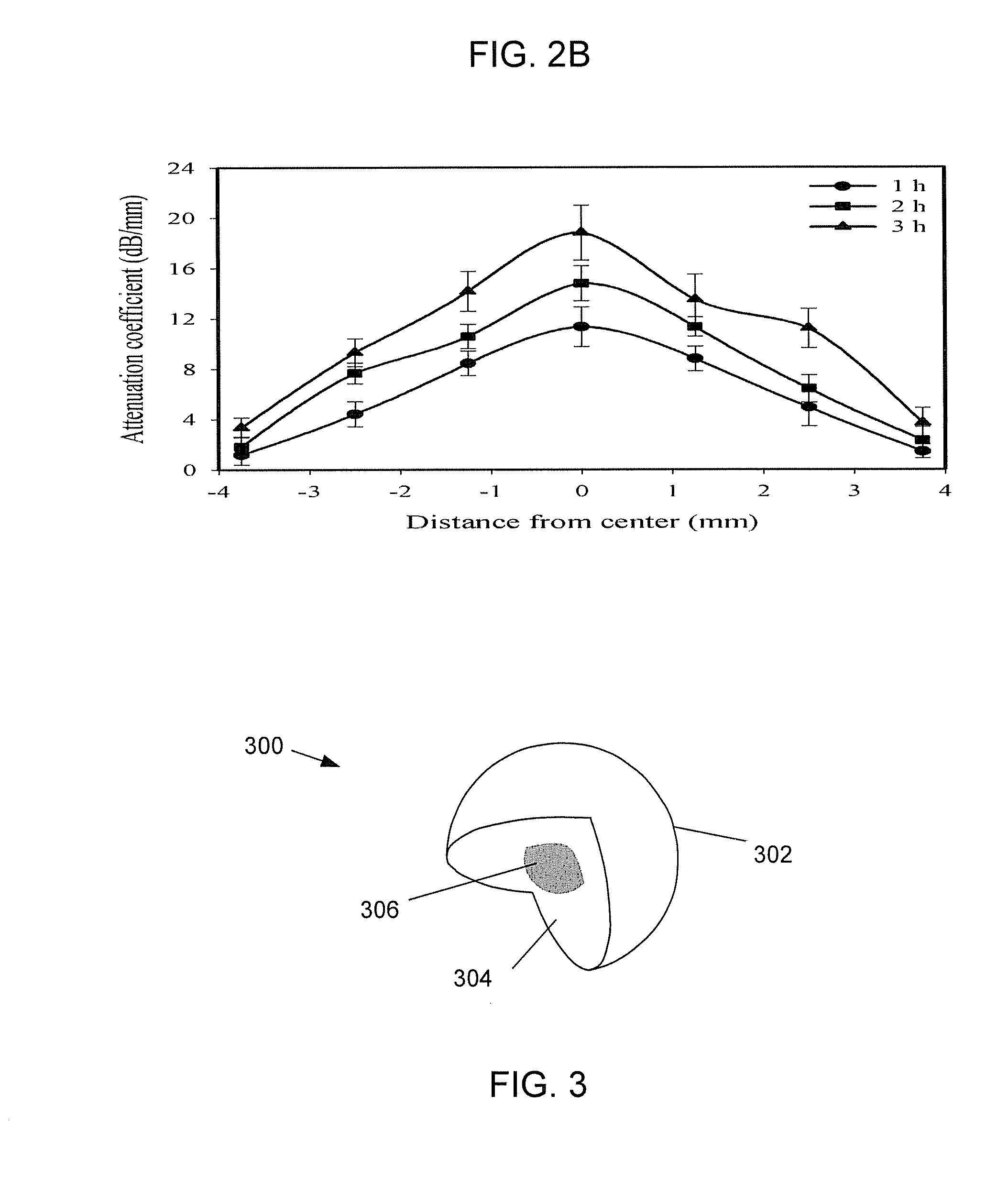 Preoperative and Intra-Operative Lens Hardness Measurement by Ultrasound