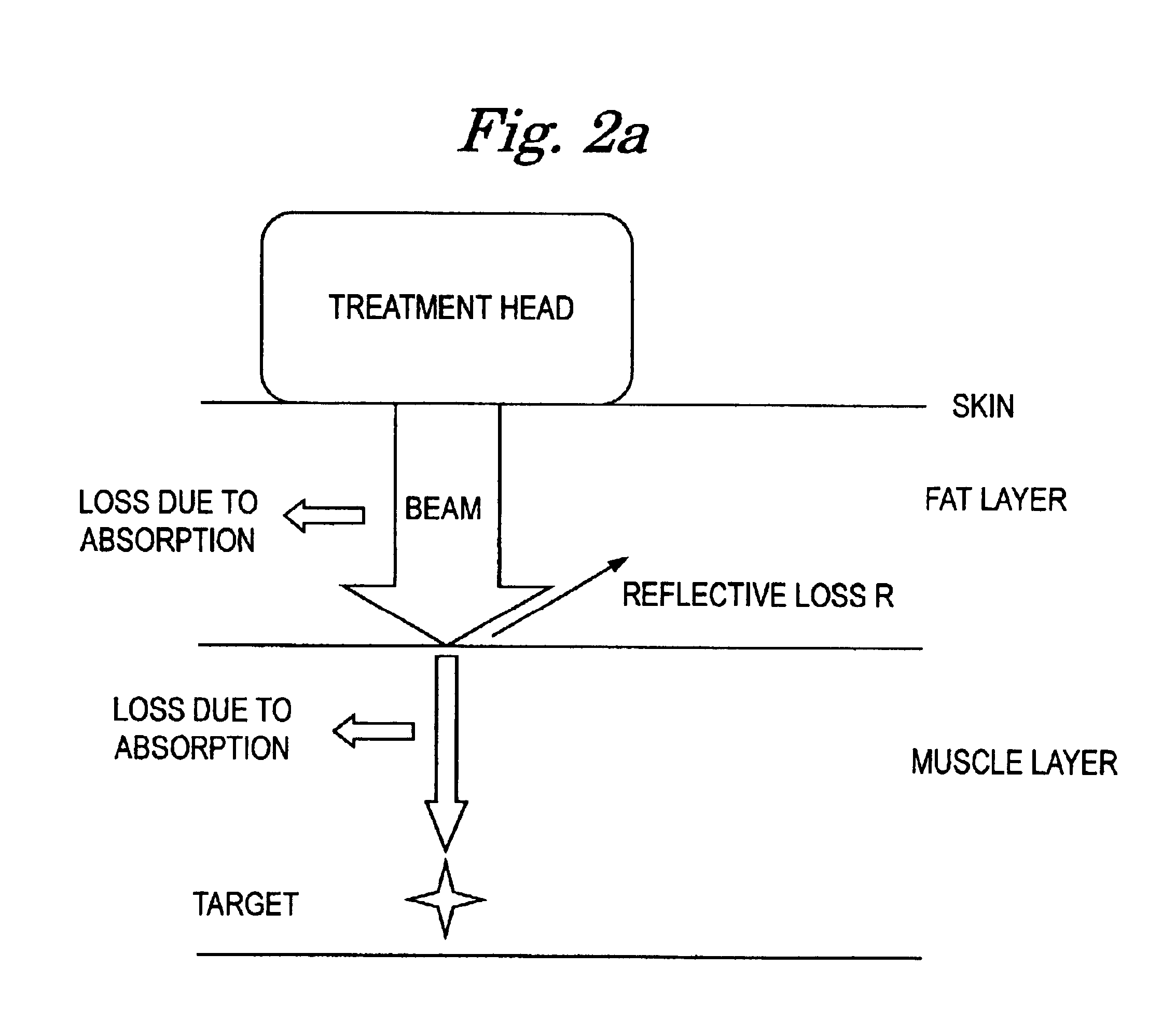 Ultrasound therapeutic device