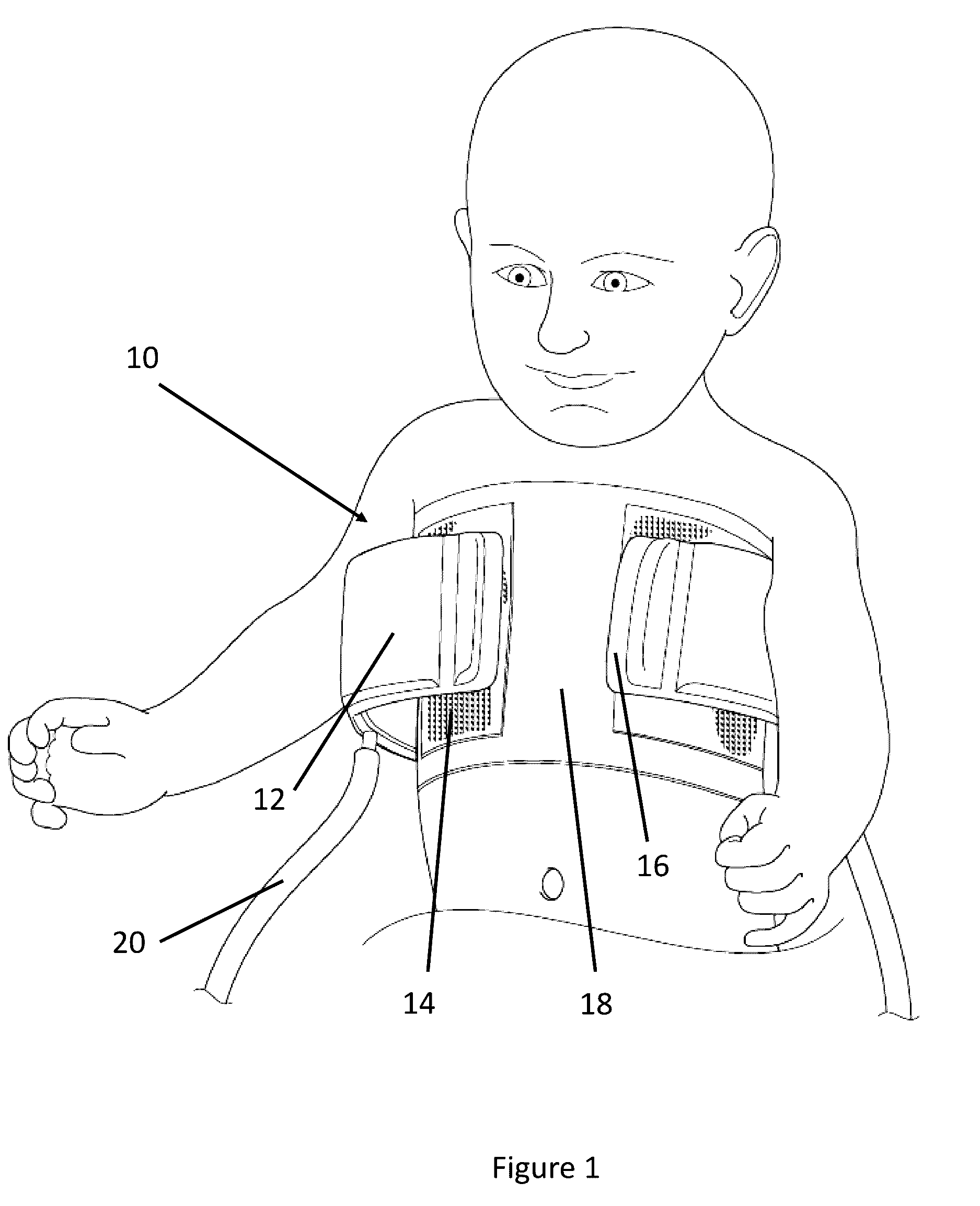 Neonatal Chest Splint for Applying Negative Distending Pressure